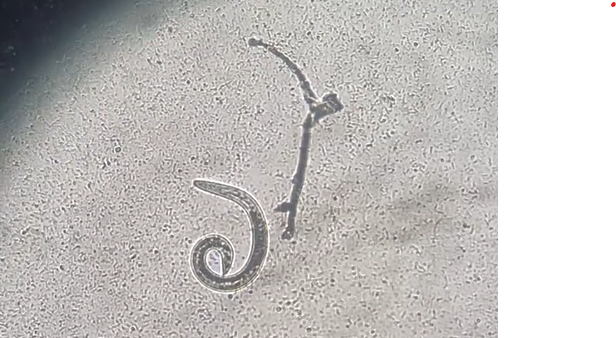 Angiostrongylus vasorum, fransk hjerteorm, hjerte-/lungeorm. Kan diagnosticeres med afføringsprøve til baermann eller blodprøve hos Frederiksværk Dyrehospital